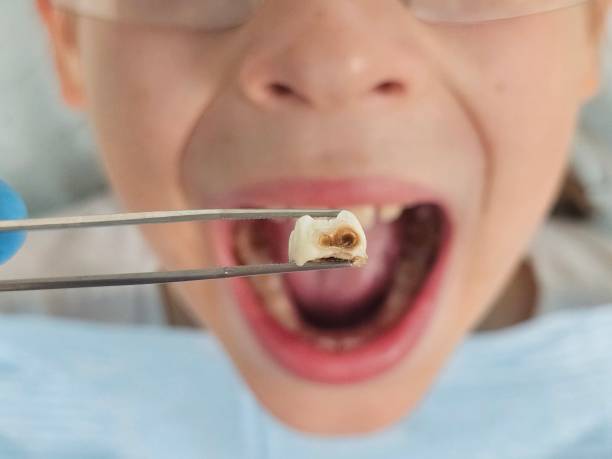 Best Emergency Pediatric Dental Care in Colquitt, GA